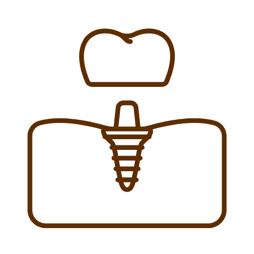 Dental Implants